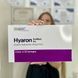 Біоревіталізант Hyaron (Хіарон) Sodium Hyaluronate &mdash; 1х2.5 мл 1949928550 фото 1